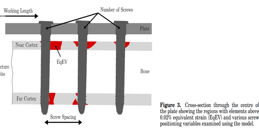Age-related optimization of screw placement