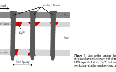 Age-related optimization of screw placement